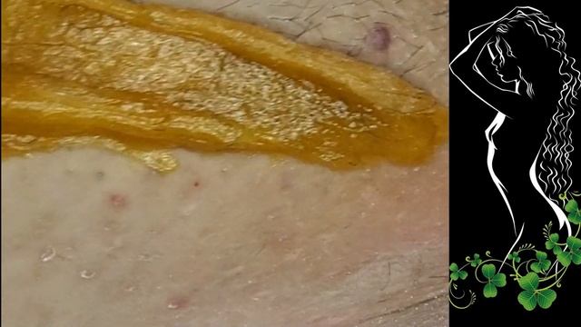 Как Удалить волосы сахаром. Шугаринг от Аллы. смотреть онлайн