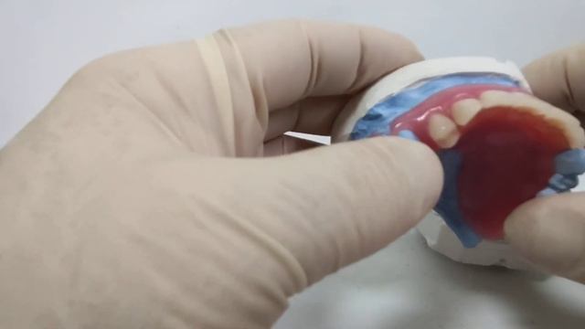 Частично съёмный протез смотреть онлайн