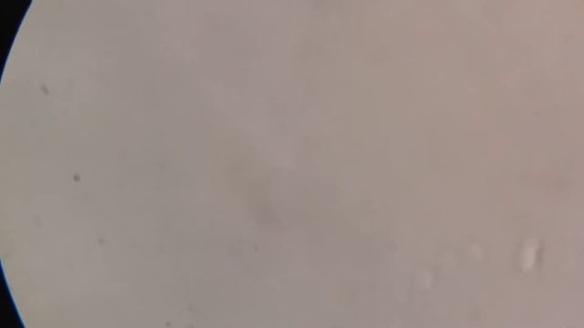 Бактерии под микроскопом. Увеличение 500х смотреть онлайн