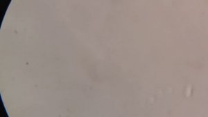 Бактерии под микроскопом. Увеличение 500х