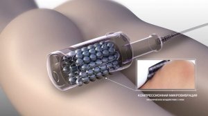 ЭНДОСФЕРА ТЕРАПИЯ