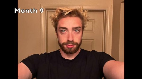 1 Year of Hair Growth | Time Lapse