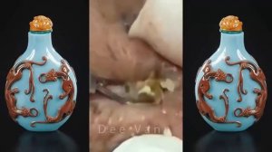 часть 21 : Удаление черных точек, полное видео от доктора Nana, Blackhead Removal.