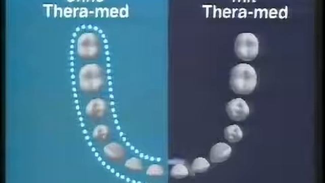 Theramed Zahncreme Werbung 1985 смотреть онлайн