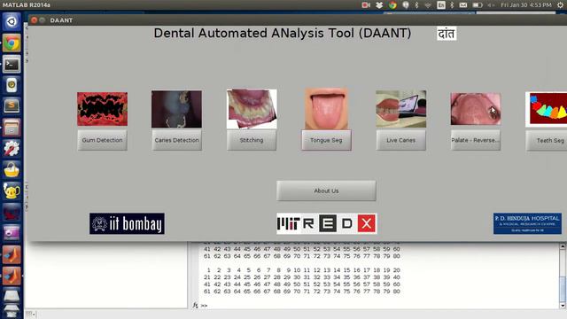 Dental Project REDX Workshop MIT Media Lab смотреть онлайн