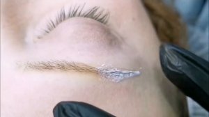 Удаление перманентного макияжа бровей ремувером Revivink plus, читай алгоритм работы в описании ❤️?