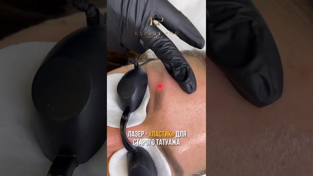 Удаляем старый татуаж навсегда?#лазерноеудаление #удаление #мастерудаления #удалениетатуажа смотреть онлайн