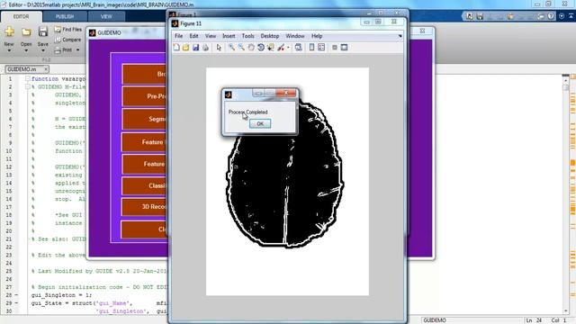 mri brain 3d reconstruction matlab PROJECTS смотреть онлайн