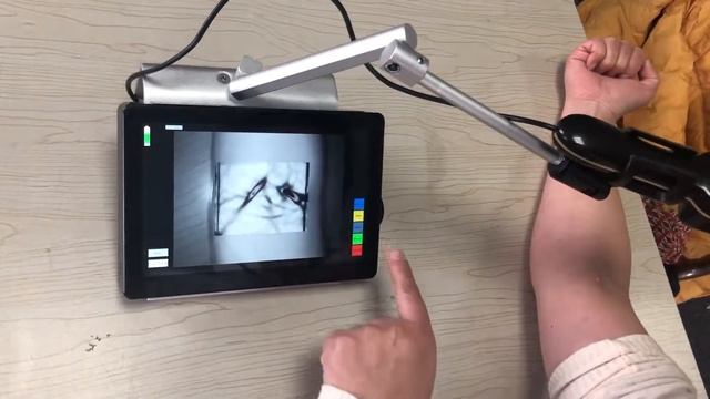 BIO-BS6000 vein finder application on the arm смотреть онлайн