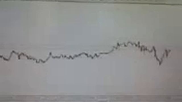 Технический Анализ (Forex, Товарный, Фондовый Рынок) Ч. 1 [Анализ Графика Форекс] смотреть онлайн