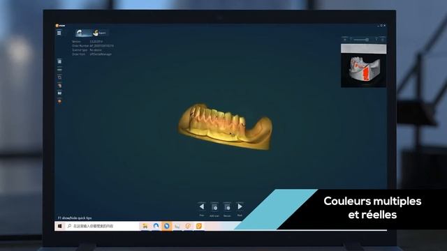 Nouveau scanner dentaire UP560 par Up3D pour Laboratoire de prothèse dentaire - Scanner CAD/CAM смотреть онлайн