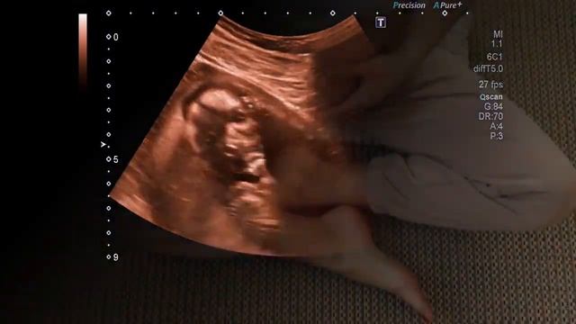 STRESS DURING PREGNANCY | 10 reasons why pregnant women should not be nervous смотреть онлайн