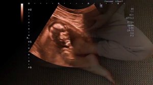 STRESS DURING PREGNANCY | 10 reasons why pregnant women should not be nervous