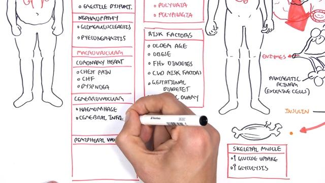 Diabetes Complication and Pathophysiology of the complication смотреть онлайн