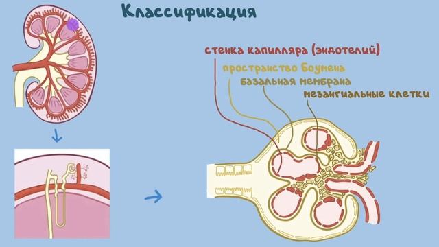 Люпус (волчаночный) нефрит, патофизиология, диагностика, лечение