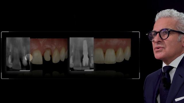 Video presentation of a clinical case on the 8-step schematic protocol смотреть онлайн