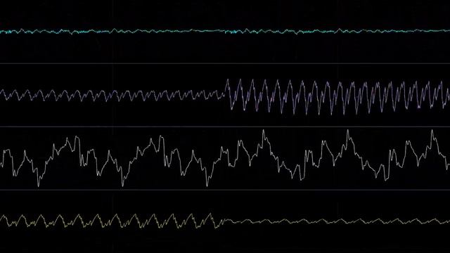 Oscilloscope view: Android - Robert A. Allen (Epic Pinball) смотреть онлайн