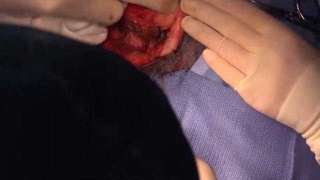 Live stream - HIGH tail amputation in a dog for mast cell tumour смотреть онлайн