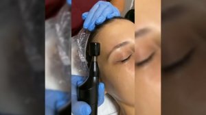 БМС (Биомеханическая стимуляция) мышц лица, головы и шеи. Аппаратный массаж.