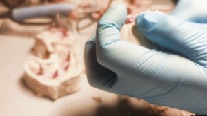 процесс изготовления условно съёмного зубного протеза с опорой на импланты