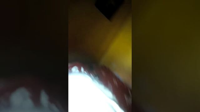 Как жить со сломанной рукой смотреть онлайн