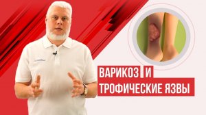Варикоз и трофические язвы на ногах