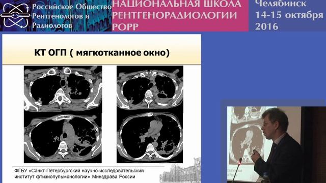 П.В. Гаврилов - Разбор клинического случая