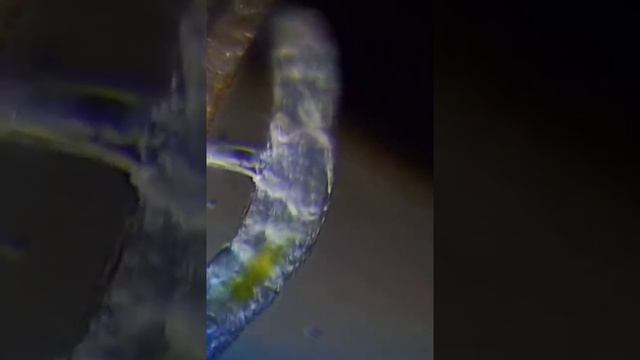 Личинка Комара Звонца под микроскопом смотреть онлайн