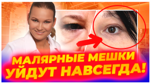 ЧИК-ЛИФТИНГ - САМАЯ МОДНАЯ ПЛАСТИКА ЛИЦА!