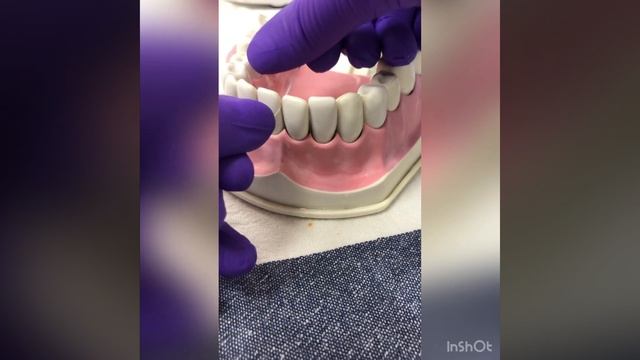 Мини экскурс по зубной нити и ирригатору? ~Стоматология~ смотреть онлайн