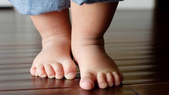 Продольное и поперечное плоскостопие: фото ног у детей, симптомы 1 2 3 4 степени у взрослых смотреть онлайн