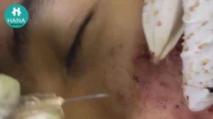 Enjoy Your Day with HANA Spa - Clinic #02