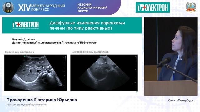 Особенности визуализации у детей на аппарате УЗИ-Электрон смотреть онлайн