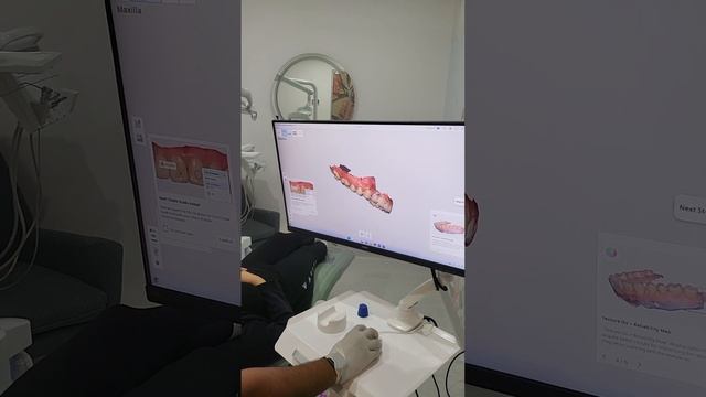 How to use Medit Scanner смотреть онлайн