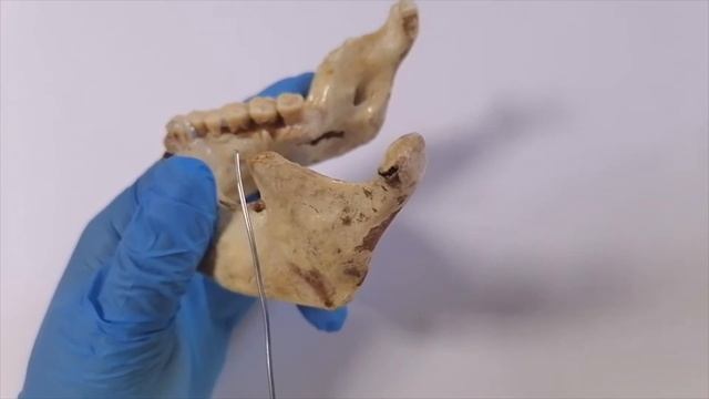 Кости лицевого черепа смотреть онлайн