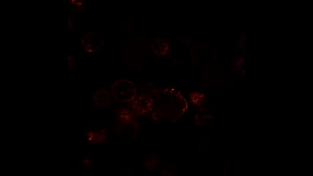 Targeting melanoma with scFv-immunoliposomes - Supplementary video 2 [96123] смотреть онлайн