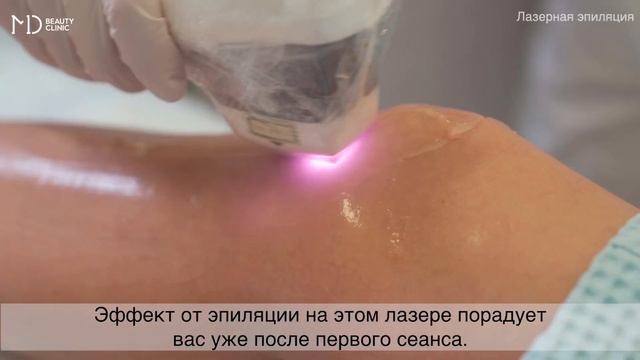 md лазерная эпиляция на диодном лазере смотреть онлайн