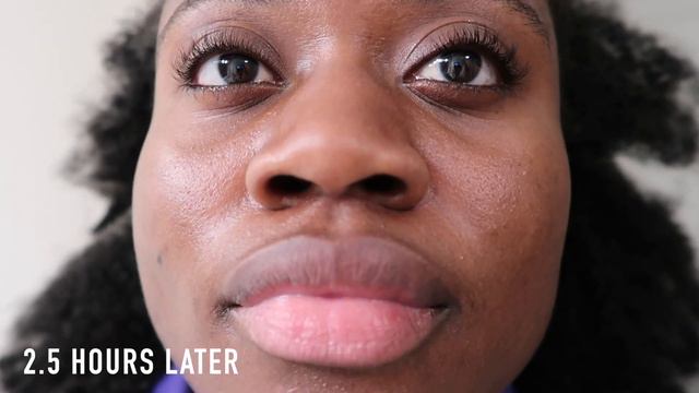 SUPERGOOP PLAY EVERYDAY LOTION SPF 50 | SUNSCREEN REVIEW ON OILY ACNE PRONE SKIN смотреть онлайн