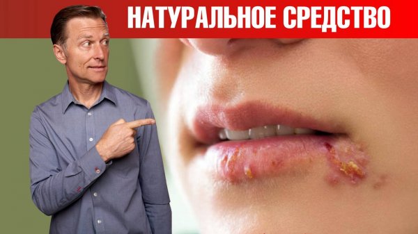 Герпес на губах? Эти 3 средства мгновенно избавят от герпеса🧐