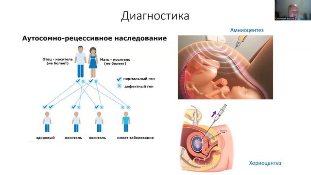 Болезнь Галлервордена-Шпатца смотреть онлайн
