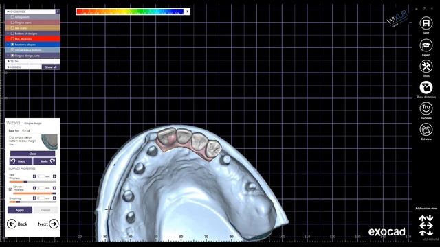 How To Design Gingiva - Exocad Full-Arch Case смотреть онлайн