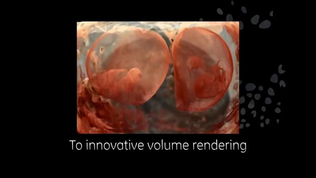 Voluson E10 смотреть онлайн