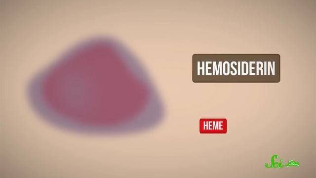 Why Do Bruises Change Colors? смотреть онлайн