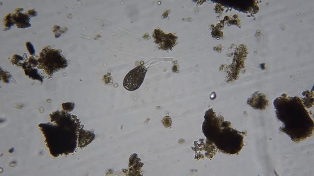 Difflugia - an amoeba in a shell смотреть онлайн