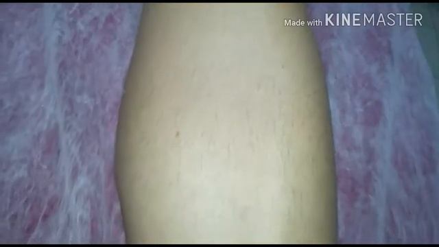 Шугаринг. До и После. смотреть онлайн