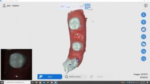 Scanning Peek Scan Body by Runyes IOS-11