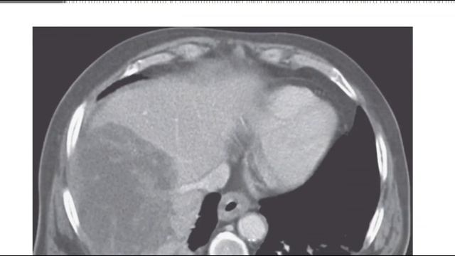 GIT MC GRAW HILL RADIOLOGY BOOKS FRCR(4) смотреть онлайн