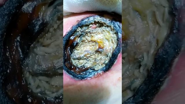 Рана смотреть онлайн