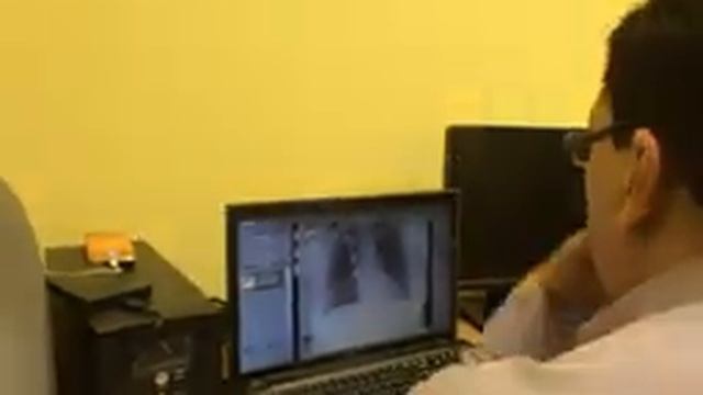 Почему лучше использовать только кассету 35х43 см смотреть онлайн