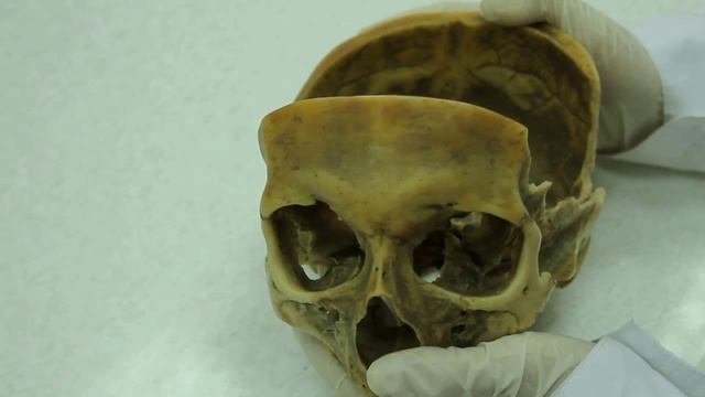 16. Половые различия черепа